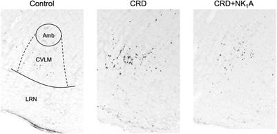 Involvement of neurokinin-1 receptors in the autonomic nervous system in colorectal distension-induced cardiovascular suppression in rats